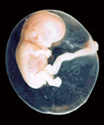 ヒト胎児